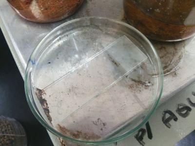 microplasticos coletados